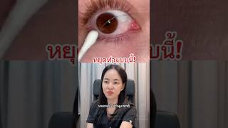 #หมอหลิน #จักษุแพทย์ #หมอตา #ศัลยกรรมตา #สารพัดเรื่องตา #โรคตา #ขี้ตาเป็นเส้นๆ #ขี้ตายืด