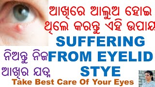 ଆଖିରେ ଆଲୁଅ ହୋଇଛି କି?,ODIA,ODIA HEALTH TIPS,CURE EYELID STYE,TAKE CARE OF YOUR EYES, VARKHA MOHAPATRA