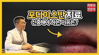 입술 좁쌀 포다이스반 치료가 어려운 이유, 흉터의 위험성은?