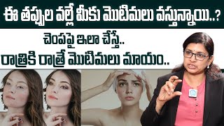 ముఖంపై మొటిమలు అస్సలు తగ్గడం లేదా..? | Dr Lalitha about Pimples on Face | @iDreamDoctor