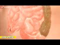 human digestive system how does our body digest food medical video