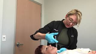 Kybella Injections with a Cannula at Elite Plastic Surgery