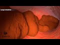 How does your body turns food into the poop? Human digestive system(Animation)|Dandelion Team