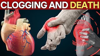 Learn how to FIGHT poor circulation and avoid a HEART attack!