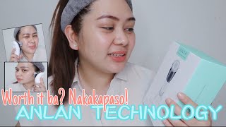 Anlan Technology | Multifunctional Hot\u0026Cold Face Massager | Review| nakakaliit ng mukha!