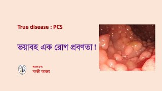 True disease PCS II Real Homoeopathy