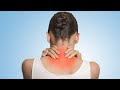 Đau Mỏi cổ Vai Gáy Liên Quan Đến Họa Và Phúc Trong Đông Y (NECK, shouder)