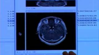 Medical analysis using grid computing