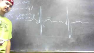 EKG.wmv