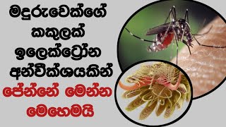 ඉලෙක්ට්‍රෝන අන්වීක්ශයකින් ජීවිතේ එදිනෙදා අපි දකින දේවල් නිරීකශනය කරොත් කොහොම පෙනෙයිද?