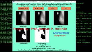Breast Cancer Identification Using Image Processing Python Project With Source Code