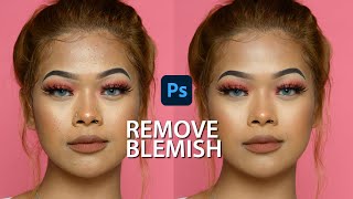 Photoshop 2021: How to Remove Blemishes and Pimples
