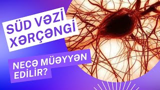 Süd Vəzi Xərçəngi Necə Müəyyən Edilir? Mammoqrafiya Nədir?