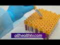 Coronavirus Update | How Coronavirus Treatments Work