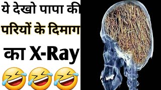 पापा की परी के दिमाग़ का X Ray - By Anand Facts | Funny videos | Amazing Facts | #shorts