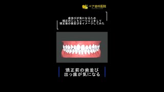 歯並びが気になるため矯正のシミュレーションをして矯正後の歯並びをイメージしてみた![ 市川市・本八幡] ペア歯科医院#shorts