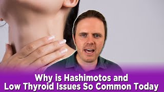 Why is Hashimotos and Low Thyroid Issues So Common Today  | Dr. J Q & A