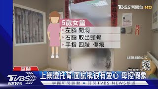 保母夫妻狠虐5歲女童 腦部開刀陷昏迷｜TVBS新聞