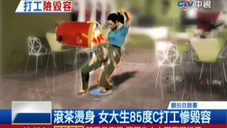 中視新聞》滾茶燙身 女大生85度C打工慘毀容