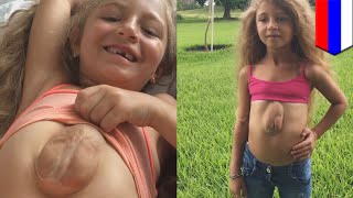 Girl born with heart outside chest: 8-year-old suffers from rare congenital condition - TomoNews