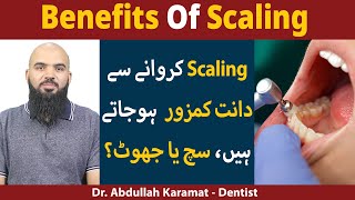 Benefits of Scaling [REALITY OF SCALING]  Scaling Ke Fayde | Myths And Misconception Of Scaling