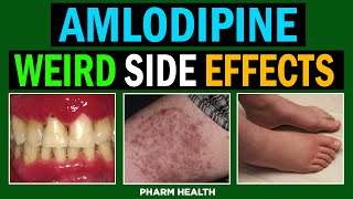 8 Weird and Unexpected Side Effects of Amlodipine (Skin, Gastrointestinal, Psychological).