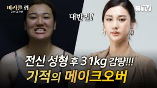 외모 때문에 이혼 당한 싱글맘의 안타까운 사연... 메이크오버 프로그램 역사상 대반전 성형과 다이어트로 역대급 변신이 시작됩니다!ㅣ거구주걱턱녀 김서진#몰아보기#미라클럽​#미인의탄생