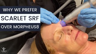Why Do We Use Scarlet SRF Instead of Morpheus8?