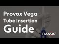 Tube Insertion Guide - Provox® Vega™ and Provox® Vega™ XtraSeal™ | Atos Medical