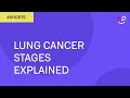 Lung Cancer Stages Explained #Shorts