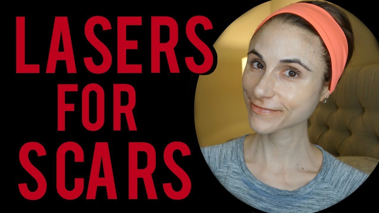 Lasers For Scars| Q&A With Dermatologist Dr Dray - YouTube