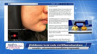 คุยข่าวเมาท์กับหมอ : รู้ทันอิทธิพล Social media  กรณีพนง.ขนส่งเจอเซ็กซ์ทอย : พบหมอรามาฯ 3.5.2562