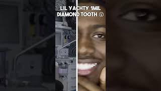 Lil Yachty's Million Dollar Smile #lilyachty #diamonds #grillz