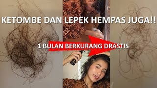 TIPS MENGATASI RAMBUT RONTOK