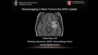 NEURORADIOLOGIA RESIDENTES-  Clase   Neuroimágenes de los tumores cerebrales  Actualización WHO