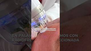 ¡RADIOFRECUENCIA FRACCIONADA con MICROAGUJAS lo MEJOR para el REJUVENECIMIENTO de tu PIEL!🫴🏻✨