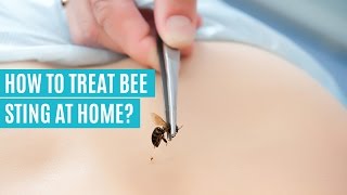 Simple & Quick Home Remedies for Minor Bee Stings!
