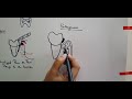 periodontal pocket part 1