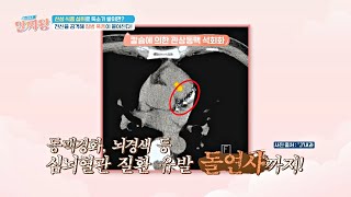 전신을 공격하는 독소, 심뇌혈관질환을 유발한다!? | TV정보쇼 알짜왕 380회 | JTBC 240801 방송