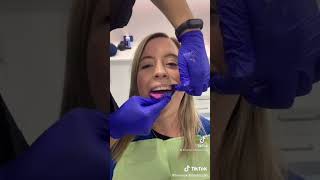 The process of making a mouthguard