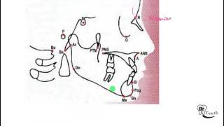 Cephalometrics Part 1