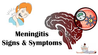 Meningitis - Signs \u0026 Symptoms |Most Common Signs \u0026 Symptoms Of Meningitis