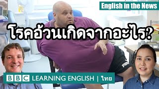 โรคอ้วนเกิดจากอะไร?