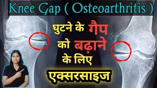 Knee gap exercises | Best exercises to increase knee gap in Osteoarthritis