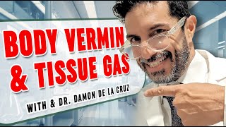 Body Vermin & Tissue Gas – What Every Embalmer Must Know!
