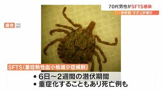 マダニにかまれた70代男性がSFTSウイルス感染　発熱などの症状で入院　大分で今年初確認