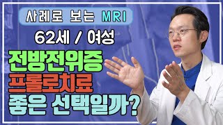 [새로운병원 척추보안관] 프롤로치료로 전방전위증 치료가 가능할까? (62세 여성 실제사례)