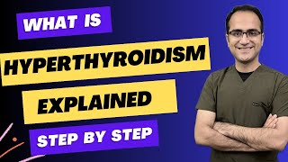 Hyperthyroidism, Graves Disease, Symptoms, Diagnosis, Wolff Chaikoff Effect, Medicine Lecture, USMLE