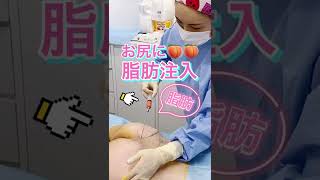 お尻の脂肪注入でプリ美尻にしてる動画♡　#Shorts