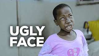 UGLY FACE (Mark Angel Comedy) (Episode 64)